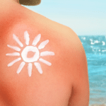 Sun Damage on Skin 